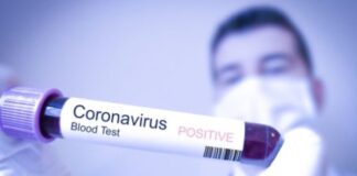 Coronavirus: 20.098 i casi positivi in Emilia-Romagna, 463 in più rispetto a ieri. Casi lievi 8.812. Guarigioni salite a 3.862 (+203), e a diminuire i ricoveri